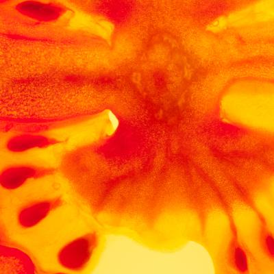 Macro 1